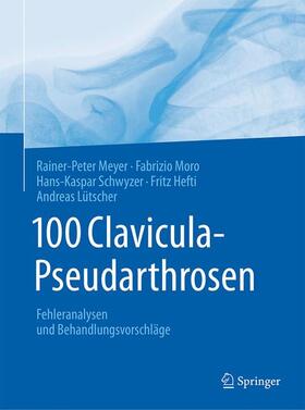 Meyer / Moro / Schwyzer | 100 Clavicula-Pseudarthrosen | Buch | 978-3-662-55344-2 | sack.de