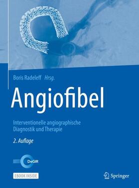 Radeleff | Angiofibel | Buch | 978-3-662-56242-0 | sack.de