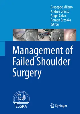 Milano / Grasso / Calvo |  Management of Failed Shoulder Surgery | eBook | Sack Fachmedien