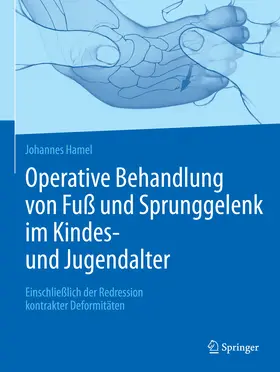 Hamel | Operative Behandlung von Fuß und Sprunggelenk im Kindes- und Jugendalter | E-Book | www.sack.de