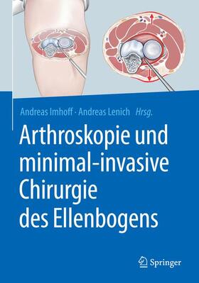 Lenich / Imhoff | Arthroskopie und minimal-invasive Chirurgie des Ellenbogens | Buch | 978-3-662-56678-7 | sack.de