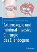 Lenich / Imhoff |  Arthroskopie und minimal-invasive Chirurgie des Ellenbogens | Buch |  Sack Fachmedien