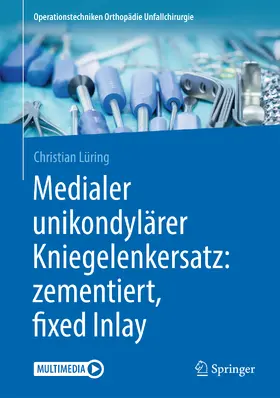 Lüring |  Medialer unikondylärer Kniegelenkersatz: zementiert, fixed Inlay | eBook | Sack Fachmedien