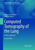 Verschakelen / De Wever |  Computed Tomography of the Lung | Buch |  Sack Fachmedien
