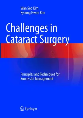 Kim |  Challenges in Cataract Surgery | Buch |  Sack Fachmedien