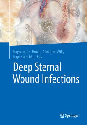 Horch / Willy / Kutschka | Deep Sternal Wound Infections | Buch | 978-3-662-57033-3 | sack.de