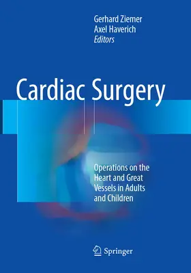 Haverich / Ziemer |  Cardiac Surgery | Buch |  Sack Fachmedien