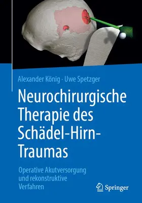 König / Spetzger |  Neurochirurgische Therapie des Schädel-Hirn-Traumas | Buch |  Sack Fachmedien