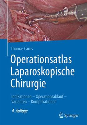 Carus | Operationsatlas Laparoskopische Chirurgie | Buch | sack.de