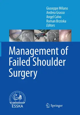 Milano / Grasso / Calvo |  Management of Failed Shoulder Surgery | Buch |  Sack Fachmedien