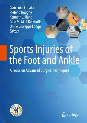 Canata / d'Hooghe / Hunt | Sports Injuries of the Foot and Ankle | E-Book | www.sack.de