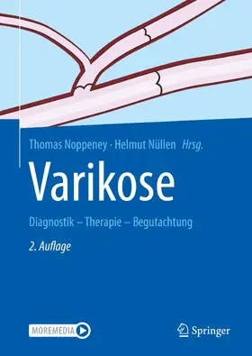 Noppeney / Nüllen | Varikose | Buch | 978-3-662-59116-1 | sack.de