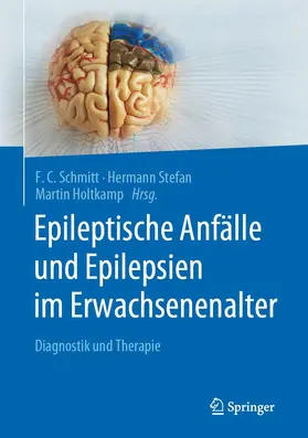 Schmitt / Stefan / Holtkamp | Epileptische Anfälle und Epilepsien im Erwachsenenalter | Buch | 978-3-662-59197-0 | sack.de