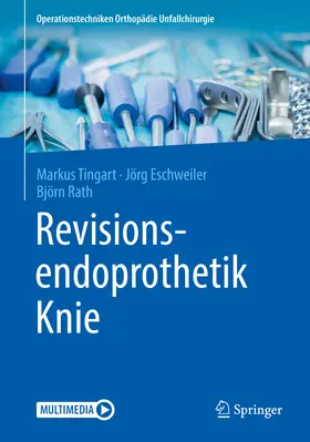 Tingart / Eschweiler / Rath |  Revisionsendoprothetik Knie | eBook | Sack Fachmedien