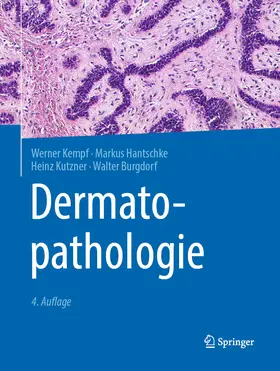 Kempf / Hantschke / Kutzner |  Dermatopathologie | eBook | Sack Fachmedien