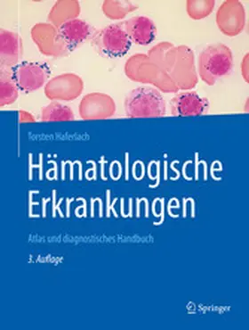 Haferlach |  Hämatologische Erkrankungen | eBook | Sack Fachmedien