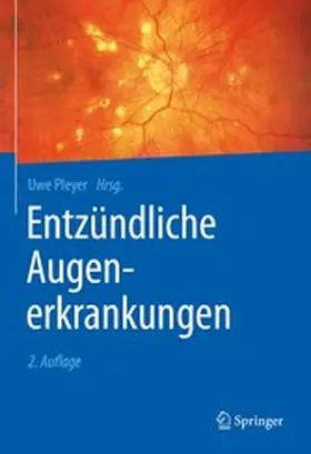 Pleyer |  Entzündliche Augenerkrankungen | eBook | Sack Fachmedien