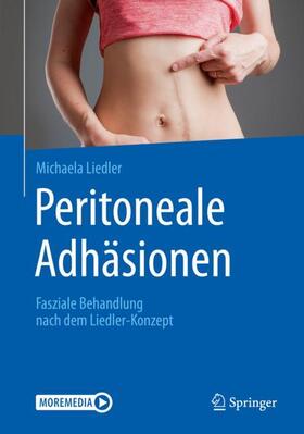 Liedler | Peritoneale Adhäsionen | Buch | 978-3-662-60499-1 | sack.de