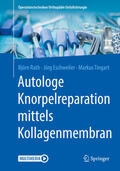 Rath / Eschweiler / Tingart |  Autologe Knorpelreparation mittels Kollagenmembran | eBook | Sack Fachmedien