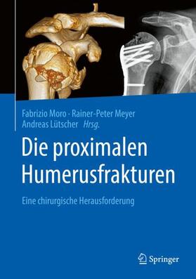 Moro / Lütscher / Meyer | Die proximalen Humerusfrakturen | Buch | 978-3-662-60852-4 | sack.de