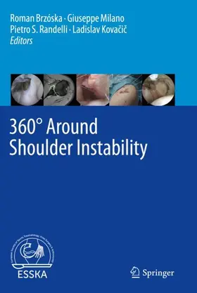 Brzóska / Milano / Randelli |  360° Around Shoulder Instability | Buch |  Sack Fachmedien