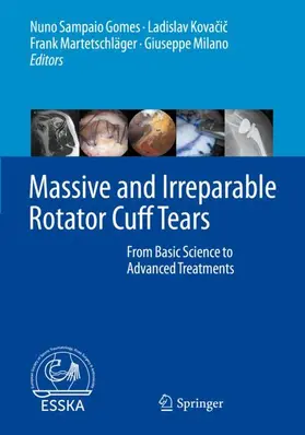 Sampaio Gomes / Kovacic / Kovacic |  Massive and Irreparable Rotator Cuff Tears | Buch |  Sack Fachmedien