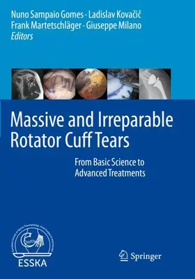 Sampaio Gomes / Kovacic / Kovacic |  Massive and Irreparable Rotator Cuff Tears | Buch |  Sack Fachmedien