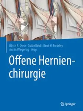 Dietz / Beldi / Fortelny | Offene Hernienchirurgie | E-Book | www.sack.de
