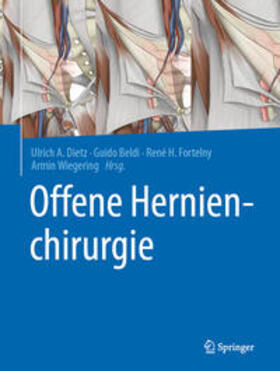 Dietz / Beldi / Fortelny | Offene Hernienchirurgie | E-Book | sack.de