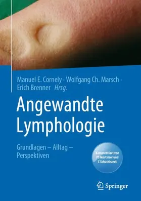 Cornely / Brenner / Marsch | Angewandte Lymphologie | Buch | 978-3-662-61451-8 | sack.de