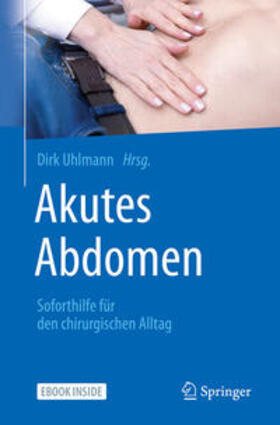 Uhlmann | Akutes Abdomen - Soforthilfe für den chirurgischen Alltag | E-Book | sack.de