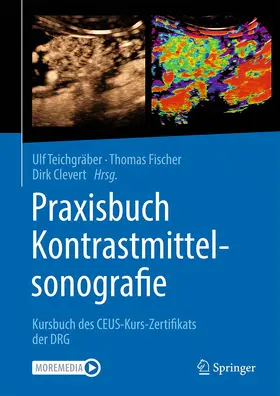 Teichgräber / Fischer / Clevert | Praxisbuch Kontrastmittelsonografie | Buch | 978-3-662-61685-7 | sack.de