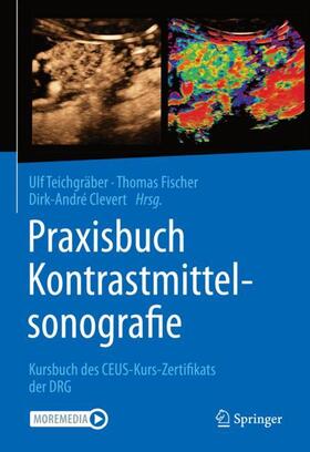 Teichgräber / Fischer / Clevert | Praxisbuch Kontrastmittelsonografie | Buch | 978-3-662-61685-7 | sack.de