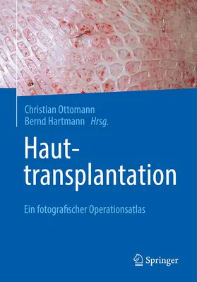 Hartmann / Ottomann | Hauttransplantation | Buch | 978-3-662-62059-5 | sack.de