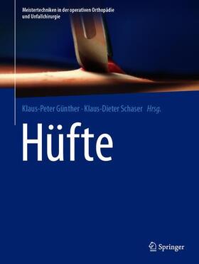Günther / Schaser | Hüfte | Buch | sack.de