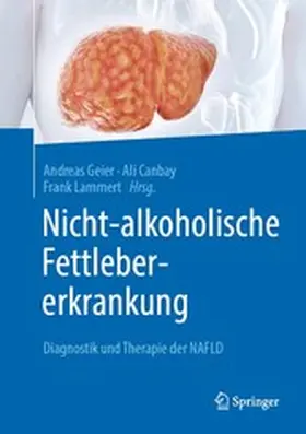 Geier / Canbay / Lammert |  Nicht-alkoholische Fettlebererkrankung | eBook | Sack Fachmedien