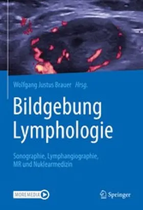 Brauer |  Bildgebung Lymphologie | eBook | Sack Fachmedien