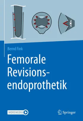 Fink | Femorale Revisionsendoprothetik | Buch | 978-3-662-62953-6 | sack.de