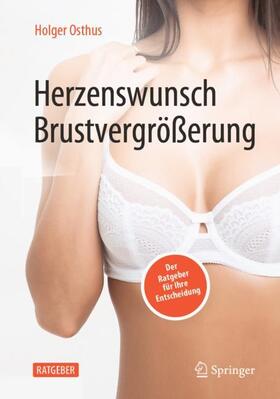 Osthus | Herzenswunsch Brustvergrößerung | Buch | 978-3-662-64316-7 | sack.de