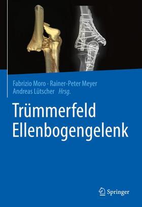Moro / Meyer / Lütscher | Trümmerfeld Ellenbogengelenk | Buch | 978-3-662-64537-6 | sack.de