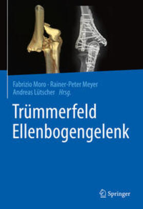 Moro / Meyer / Lütscher | Trümmerfeld Ellenbogengelenk | E-Book | sack.de
