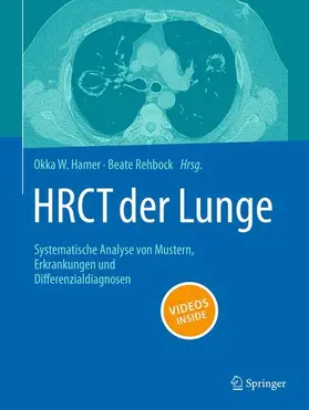 Hamer / Rehbock |  HRCT der Lunge | Buch |  Sack Fachmedien