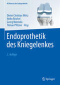 Wirtz / Reichel / Matziolis |  Endoprothetik des Kniegelenkes | eBook | Sack Fachmedien