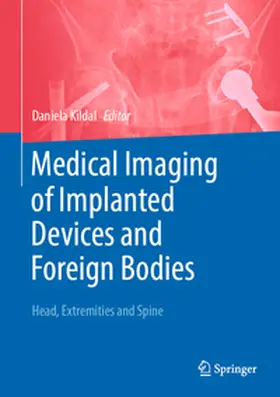 Kildal |  Medical Imaging of Implanted Devices and Foreign Bodies | Buch |  Sack Fachmedien