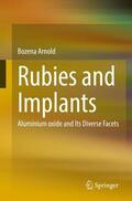 Arnold |  Rubies and Implants | Buch |  Sack Fachmedien