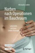 Liedler |  Narben nach Operationen im Bauchraum | Buch |  Sack Fachmedien