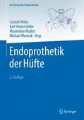 Perka / Heller / Rudert |  Endoprothetik der Hüfte | Buch |  Sack Fachmedien