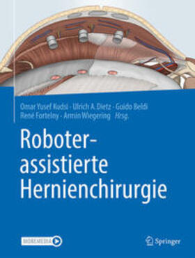 Kudsi / Dietz / Beldi |  Roboterassistierte Hernienchirurgie | Buch |  Sack Fachmedien