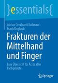 Cavalcanti Kußmaul / Unglaub |  Frakturen der Mittelhand und Finger | Buch |  Sack Fachmedien