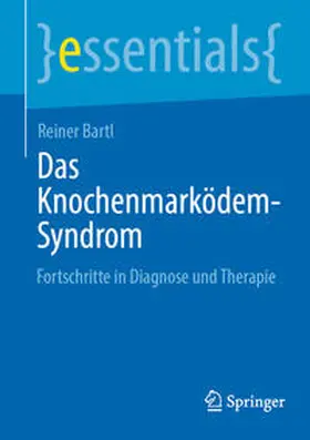 Bartl | Das Knochenmarködem-Syndrom | E-Book | sack.de